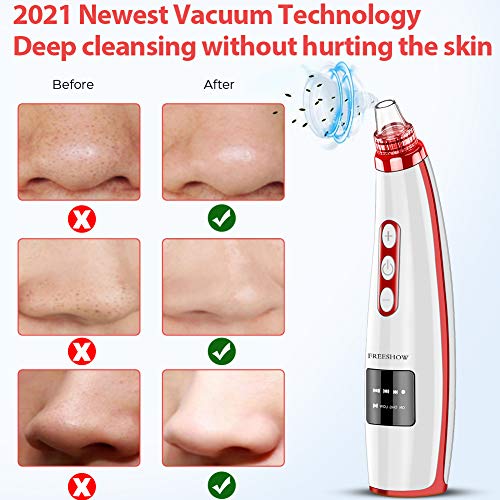 2022 Najnoviji Vakuumski Čistač Pora za uklanjanje akni,Poboljšani Čistač Pora lica,Električni Alat za uklanjanje